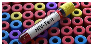 How Elisa Kits Diagnose Hiv Virus