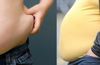 10 Natural Ways For Treating Obesity