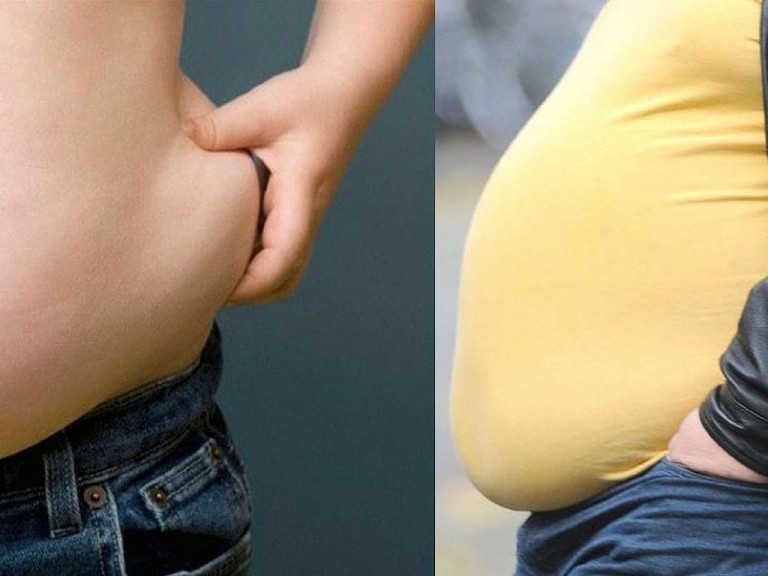 10 Natural Ways For Treating Obesity