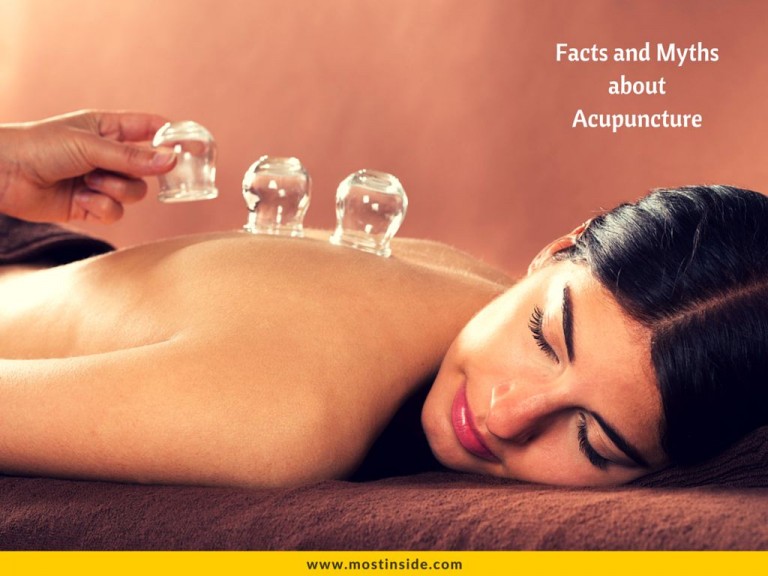 Facts and Myths about Acupuncture