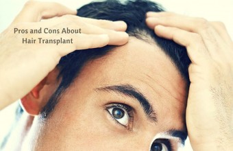 Pros and Cons About Hair Transplant