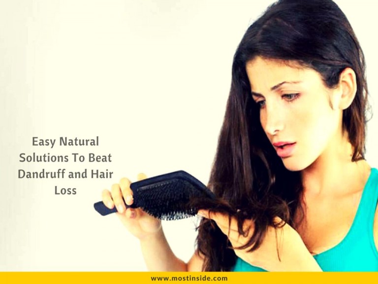 Easy Natural Solutions To Beat Dandruff and Hair Loss