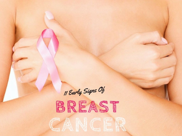 11 Early Signs Of Breast Cancer One Should Know