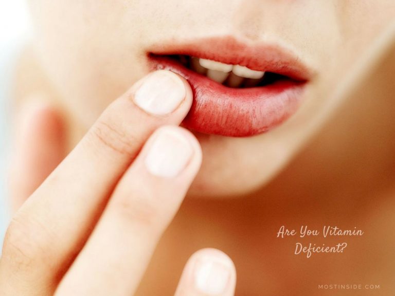 Are You Vitamin Deficient?