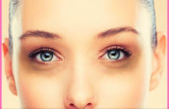 11 Major Causes Of Dark Circles