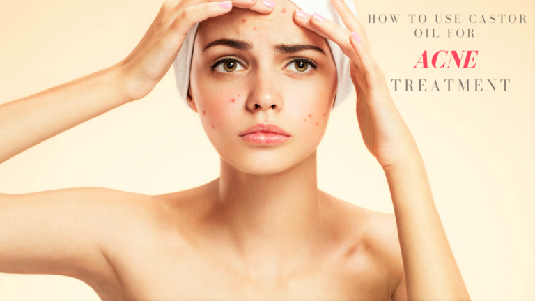 How To Use Castor Oil For Acne Treatment?
