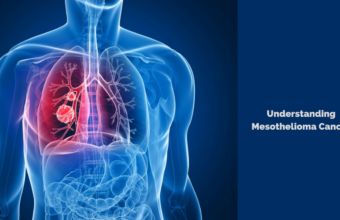 Understanding Mesothelioma Cancer