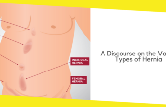 A Discourse on the Various Types of Hernia