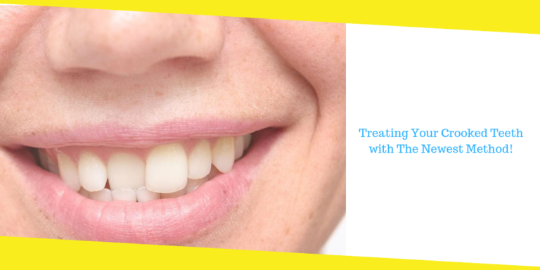 Treating Your Crooked Teeth with The Newest Method!