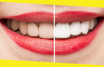 Dummies Guide to Teeth Whitening Products in Australia