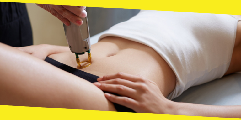 Essential Questions to Ask your Laser Hair Removal Aesthetician