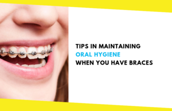 Tips in Maintaining Oral Hygiene When You Have Braces