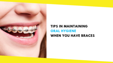 Tips in Maintaining Oral Hygiene When You Have Braces