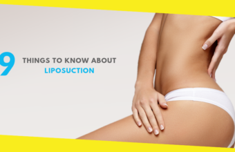 9 Things to Know About Liposuction