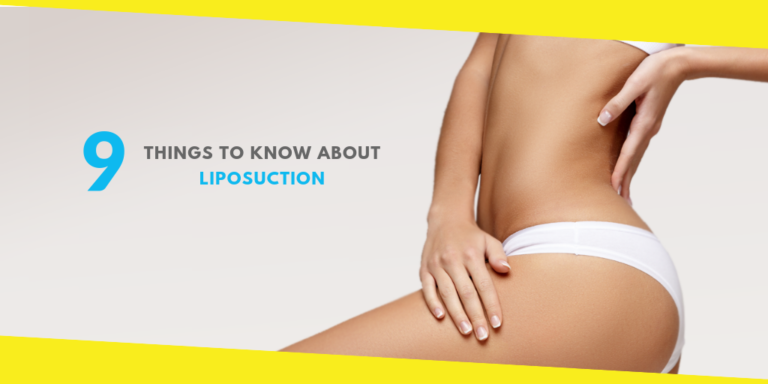 9 Things to Know About Liposuction
