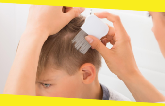 A Definitive Guide for Lice Treatment and Diagnosis