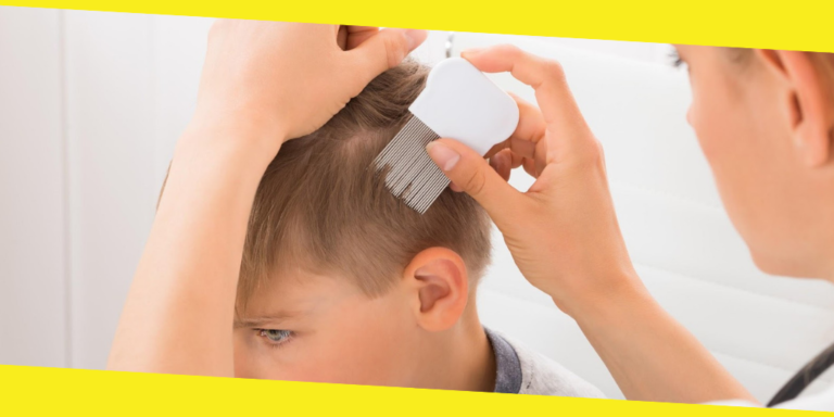 A Definitive Guide for Lice Treatment and Diagnosis