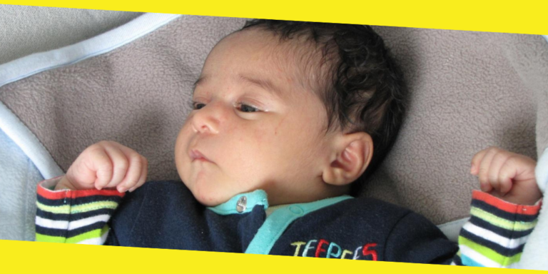 What if Baby Acne Doesn’t Go Away?