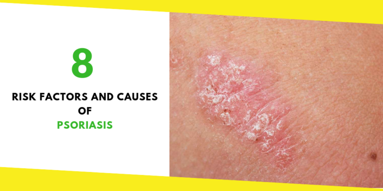 8 Risk Factors and Causes of Psoriasis