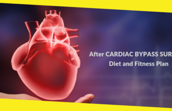 After Cardiac Bypass Surgery Diet and Fitness Plan