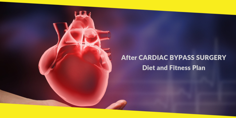 After Cardiac Bypass Surgery Diet and Fitness Plan