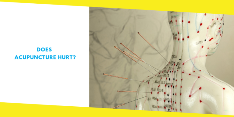 Does Acupuncture Hurt? Here Are Some Things To Expect While Getting Acupuncture