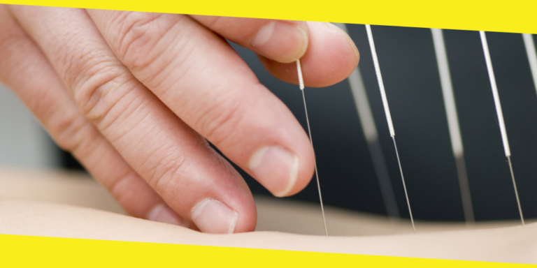 Not Into Needles? There Are More Benefits to Acupuncture Than Just Pain Relief