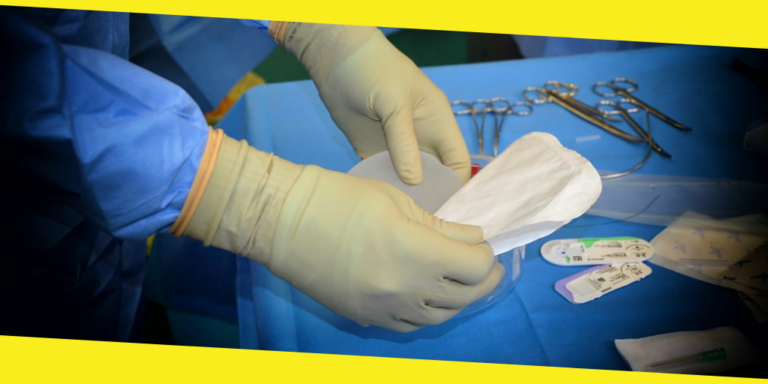 Things to Consider Before Getting Breast Implants