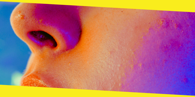 Can You Be Allergic to Benzoyl Peroxide?