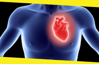 Is A Heart Transplant Recommended For You?