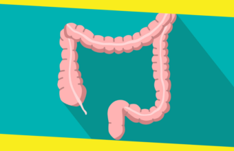 Information On Colon Cancer And The Latest Treatment Option 