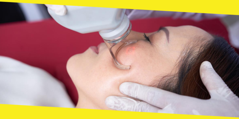 Fractional CO2 Laser in Singapore: What to Expect
