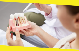 Dental Implants Singapore: The Gold Standard for Tooth Replacement