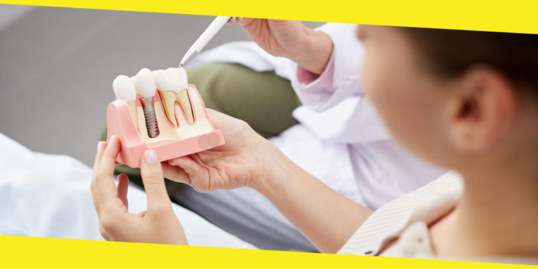 Dental Implants Singapore: The Gold Standard for Tooth Replacement