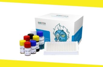 Fibronectin ELISA Kit Vs EGF ELISA Kit