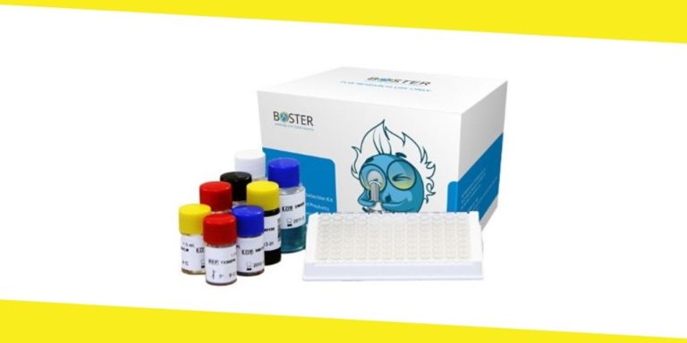 Fibronectin ELISA Kit Vs EGF ELISA Kit