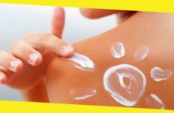 How To Treat Sunburn: 10 Effective Tips