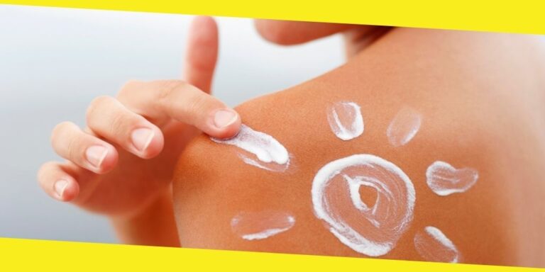 How To Treat Sunburn: 10 Effective Tips