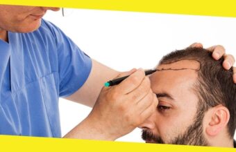 Turkey Hair Transplant – an Overview