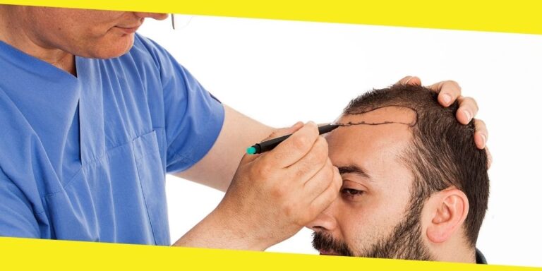 Turkey Hair Transplant – an Overview