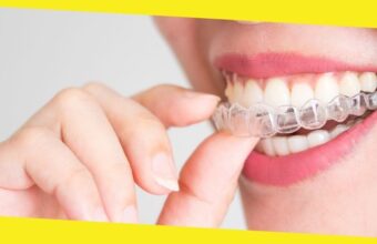 Invisalign The Coolest Dental Product