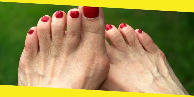 How To Handle Your Tailor’s Bunion