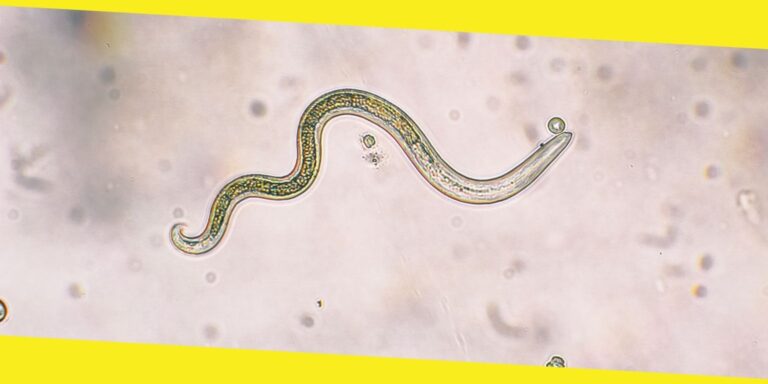 Should You Consider Using A Parasite Cleanse Kit?