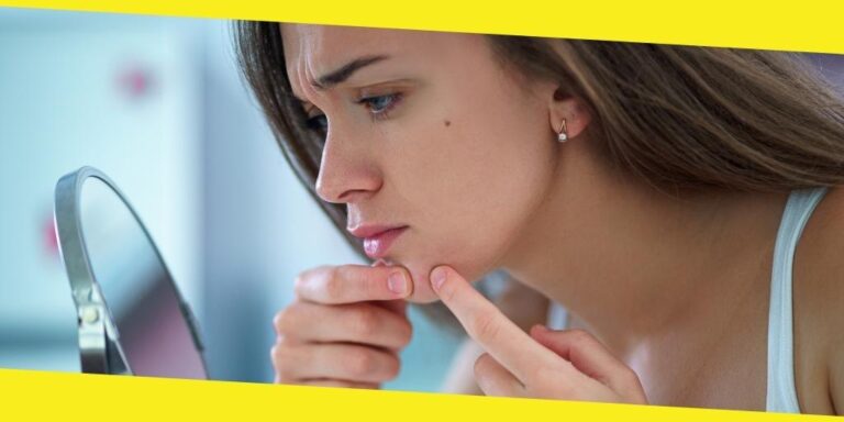 4 Benefits of Probiotic Skincare