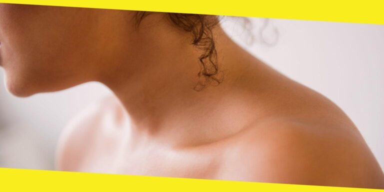 Neck Lines: Causes, Prevention & Treatment