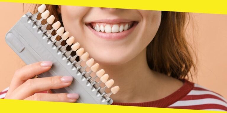 All You Need to Know Concerning Veneers