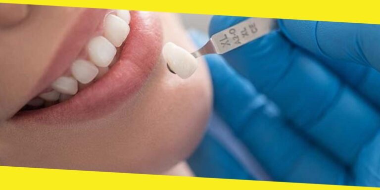 Getting a Perfect Smile with Porcelain Veneers