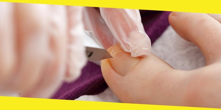 Forget Ingrown Toenails With These 7 Tips and Tricks
