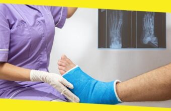 Top Myths About Bone Fractures