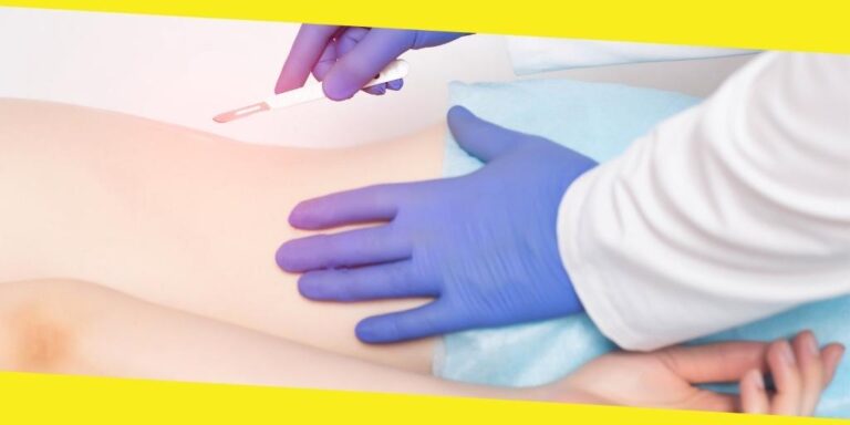 Why You Would Need Spinal Surgery